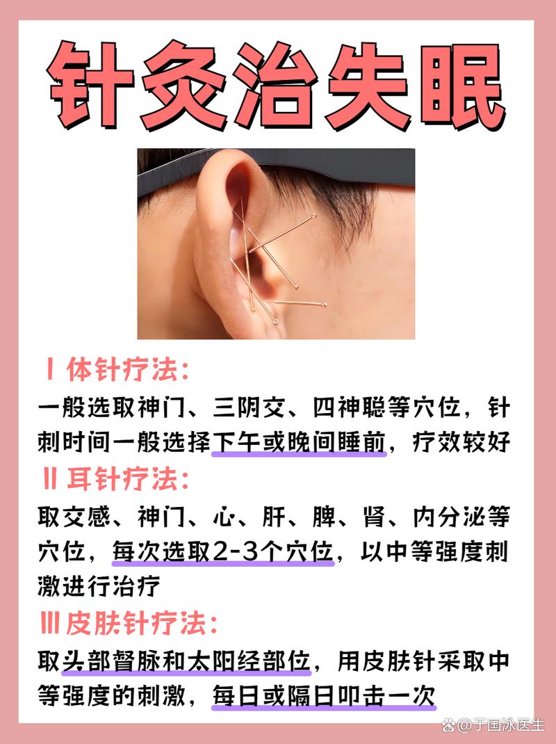针灸治疗失眠的效果和优势