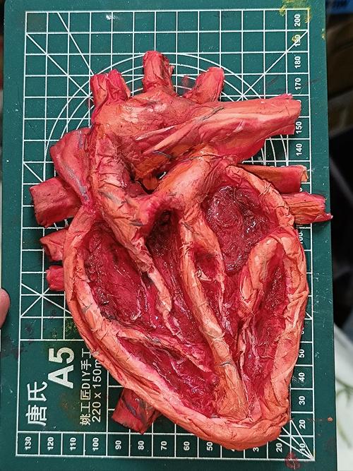 3D心脏模型的构建