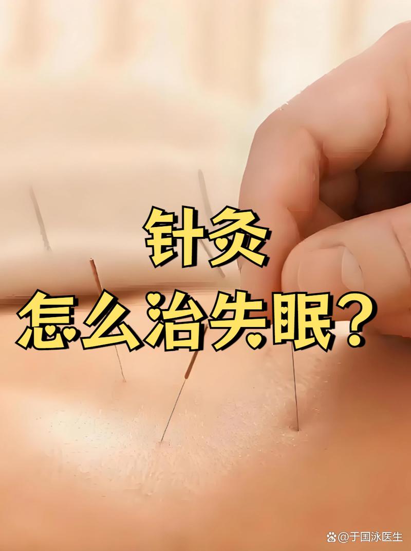 针灸治疗失眠的效果和优势