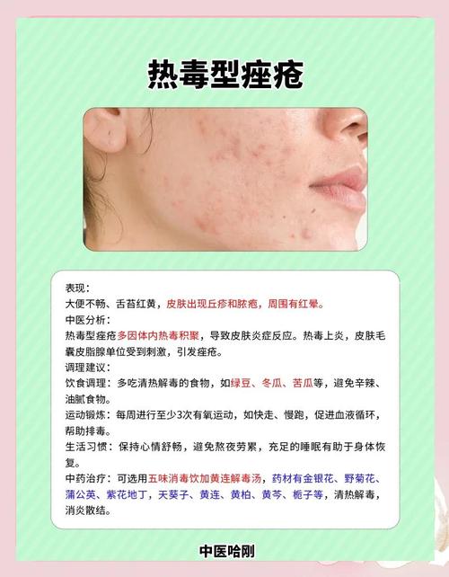中医治疗粉刺的研究进展